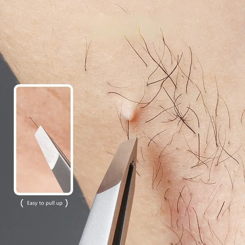 Stainless Steel Oblique Eyebro - Eyelash Extension For No Eyelid incelemesi ve fiyatı